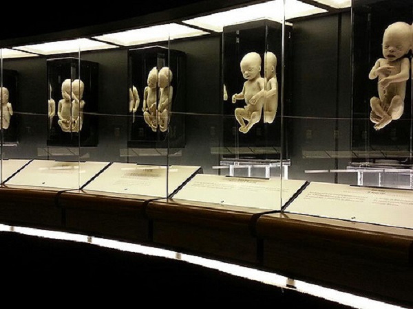 Incredible Display With The Bodies Of Miscarried Babies Reveals The