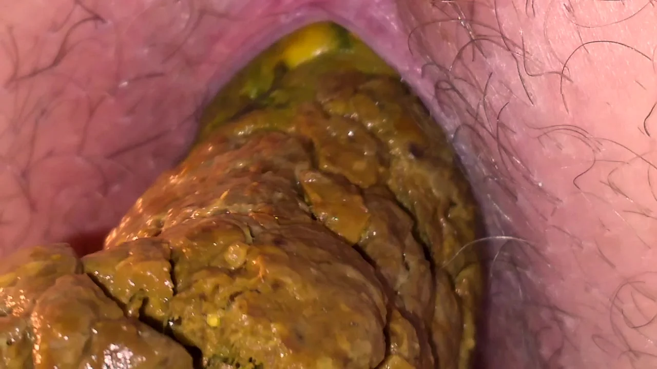 Close Up Poop Gay Scat Porn At Thisvid Tube