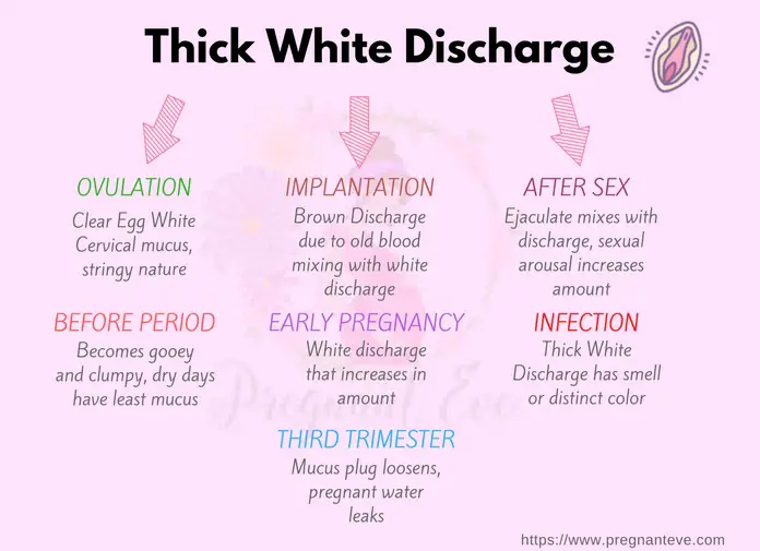 Thick White Discharge Types Causes And Treatment