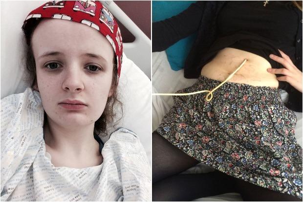 Starving Perth Teen Had Rare Gut Condition Misdiagnosed As Eating