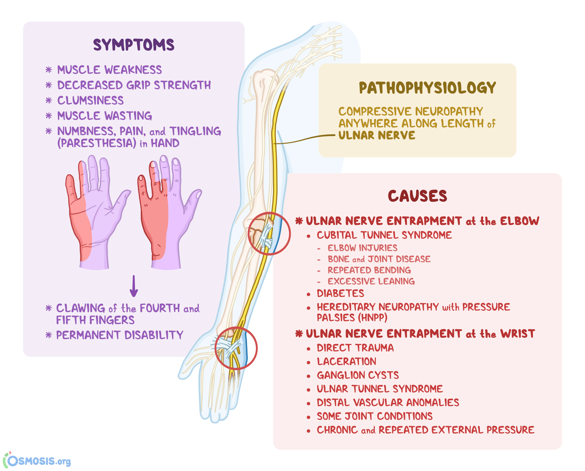 How To Fix Ulnar Nerve Entrapment Causes And Symptoms Gymless