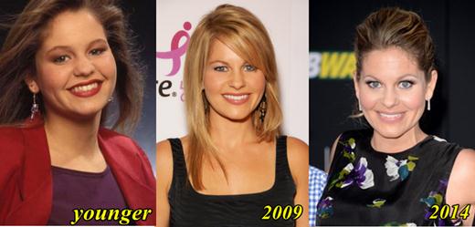 Candacecameron Plastic Surgery Before And Pictures Tease