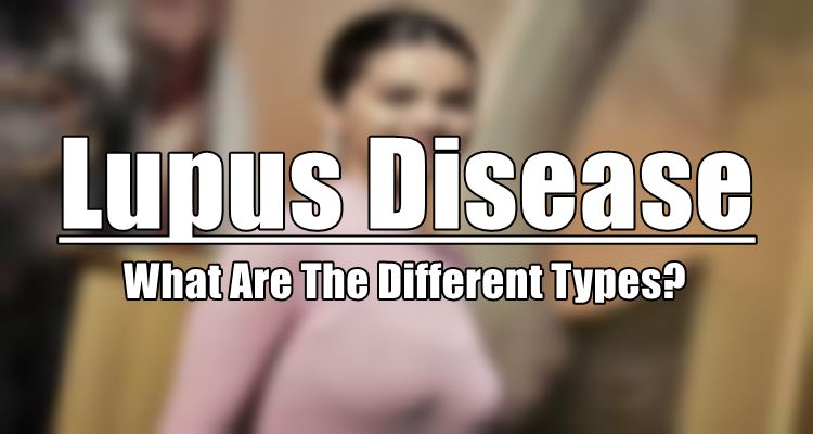Lupus Disease What Are The Different Types Of This Disease