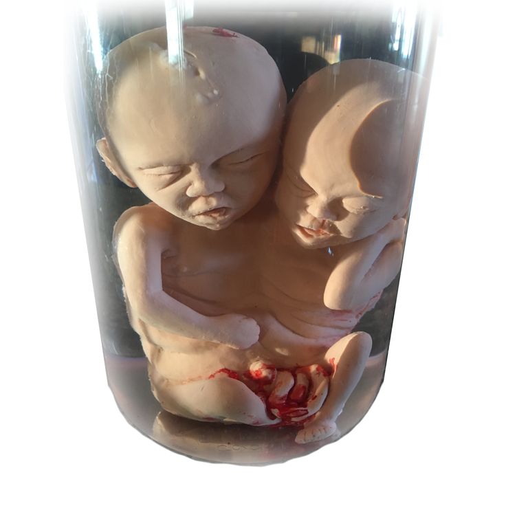 Siamese Twins Fetus Prop Fotos