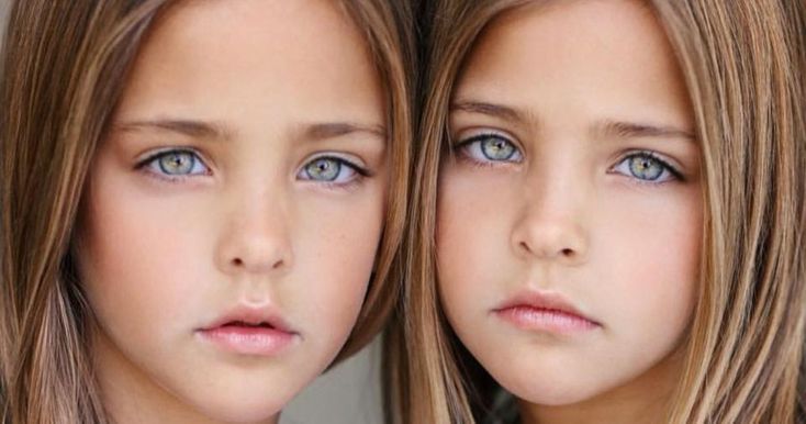 Social Media Named These Identical Sisters The ‘most Beautiful Twins In