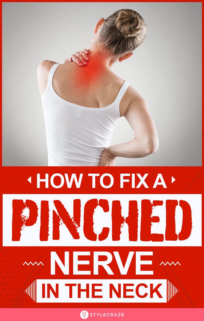 Pinched Nerve In The Neck Causes Symptoms How To Fix It Artofit