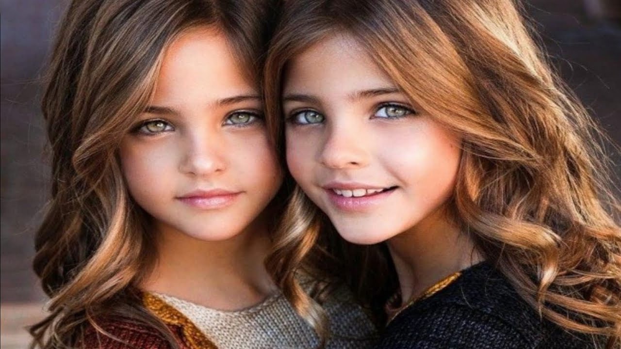 Wait Until You See The Most Beautiful Twins In The World Now Youtube
