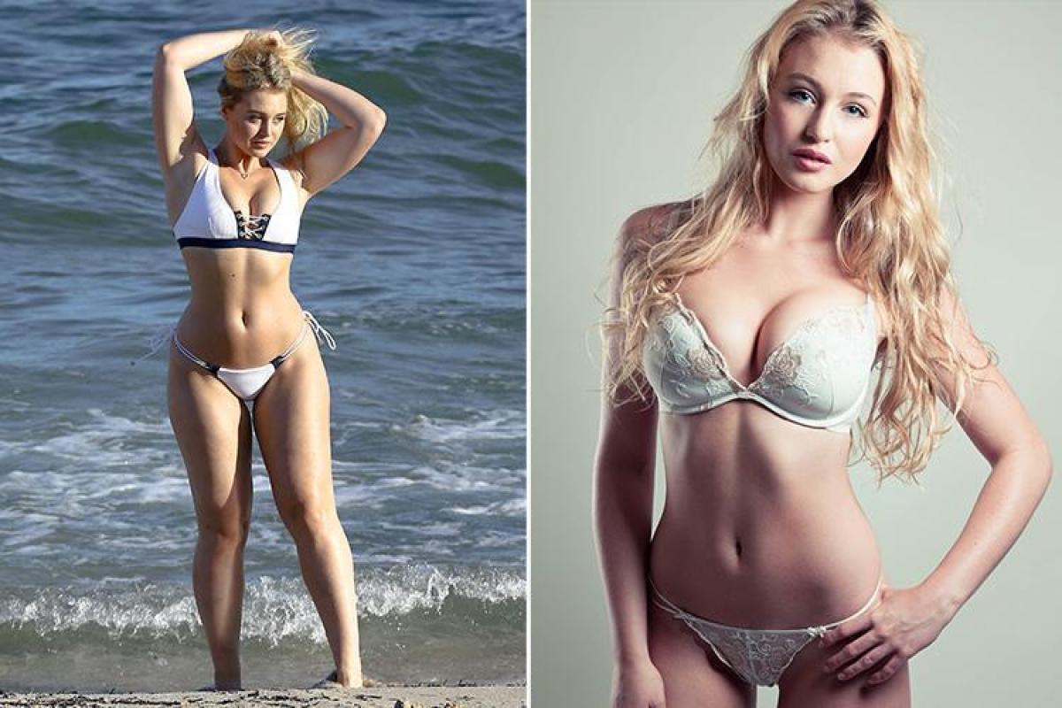 Model Iskra Lawrence Shares Powerful Before And After