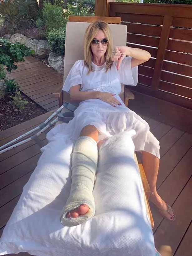 Amanda Holden Swam Back To Shore One Legged After Gruesome Holiday