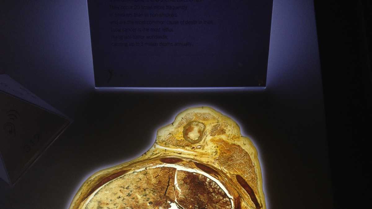 Images Body Worlds Exhibit Opens At Kentucky Science Center