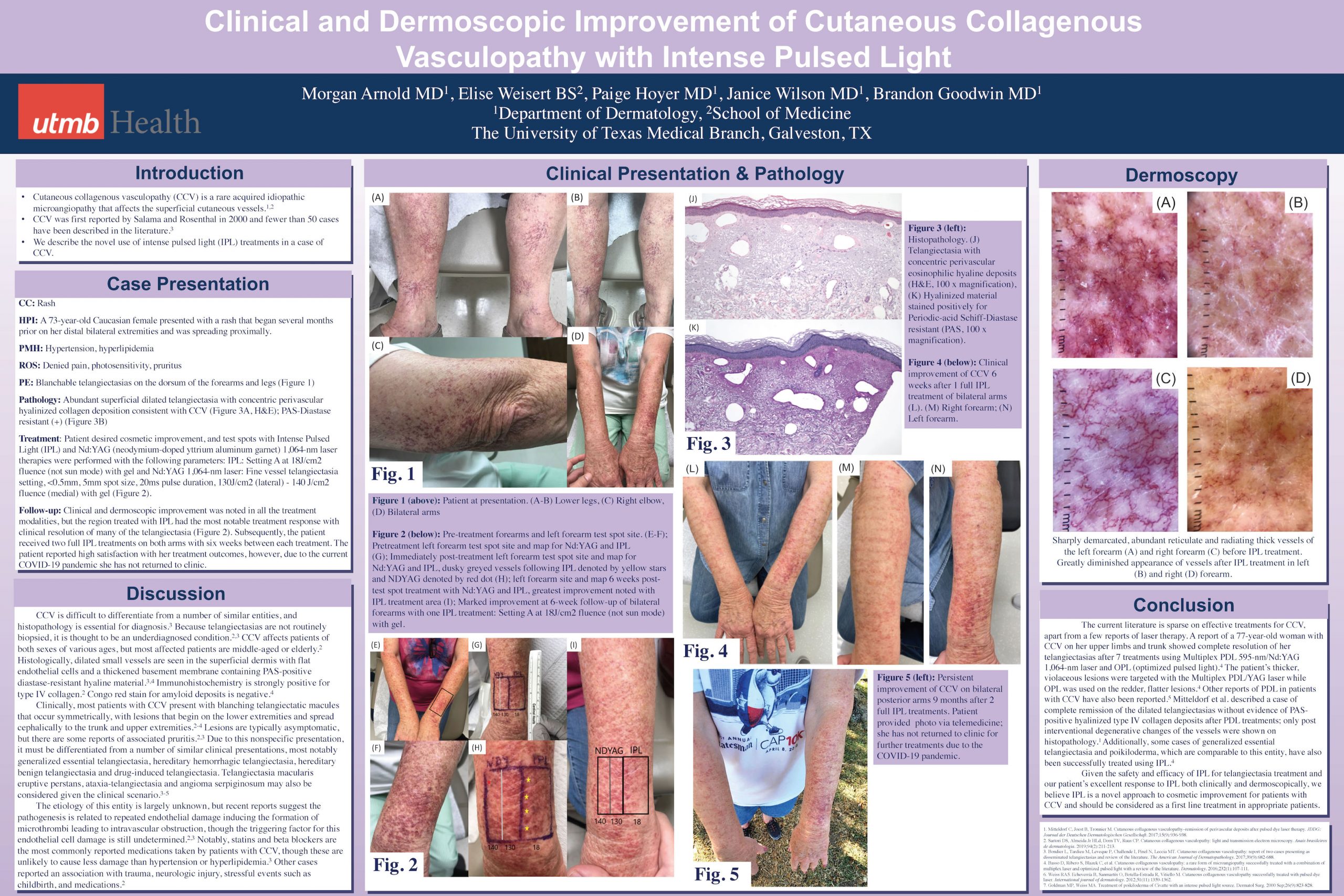 Odac Scientific Poster Series Clinical And Dermoscopic Improvement Of